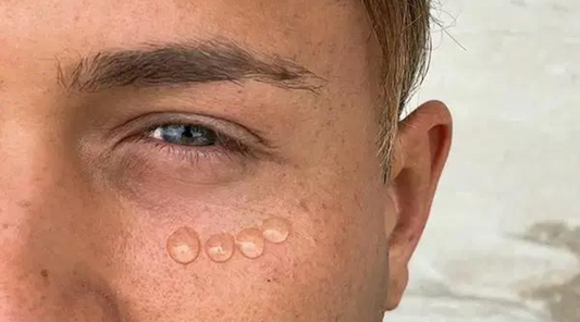 The Art of Applying Eye Gel