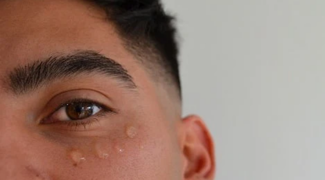 Why Men Need to Take Care of the Skin Under Their Eyes